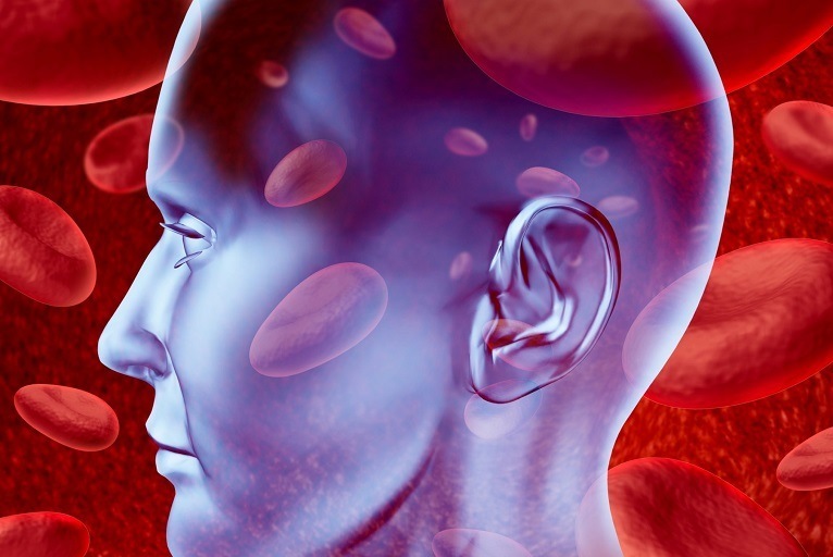 Midterm CARAS study results show cerebral ischaemic event incidence “should not be underestimated”