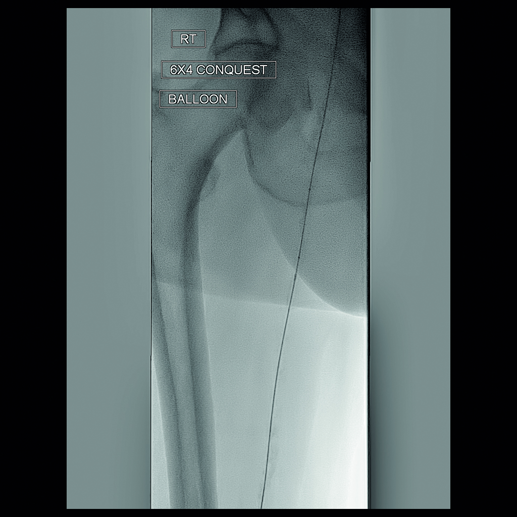 Radiation safety session seeks to address variability and improve access to education