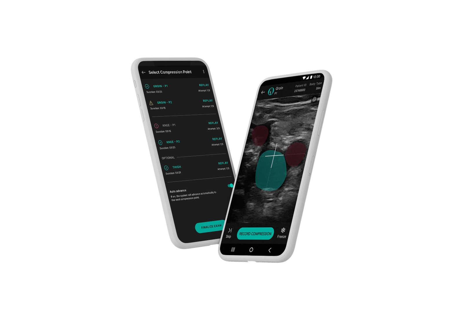 Novel AI-assisted DVT diagnostic pathway aims to ‘democratize’ point-of-care ultrasound