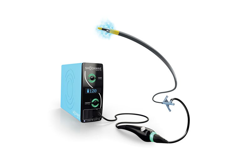 Shockwave Javelin peripheral IVL catheter meets prespecified efficacy and safety performance goals in feasibility and IDE studies