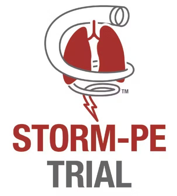 Penumbra’s STORM-PE randomized trial completes enrollment