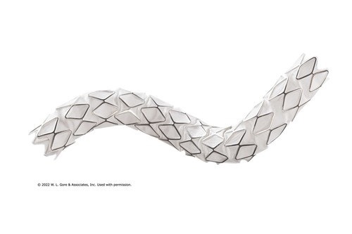 Gore announces MDR expanded indication for the Viabahn VBX balloon-expandable endoprosthesis as a bridging stent