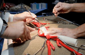 Explore the future of vascular surgery at Touchpoint@VAM