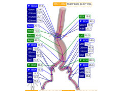 ViTAA Medical announces FDA 510(k) clearance for aortic planning platform