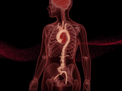 RapidAI earns US FDA clearance for AI-driven aortic measurement and surveillance product